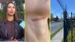 Cable en desuso en Temuco enreda cuello a ciclista: “Me pudo costar la vida”